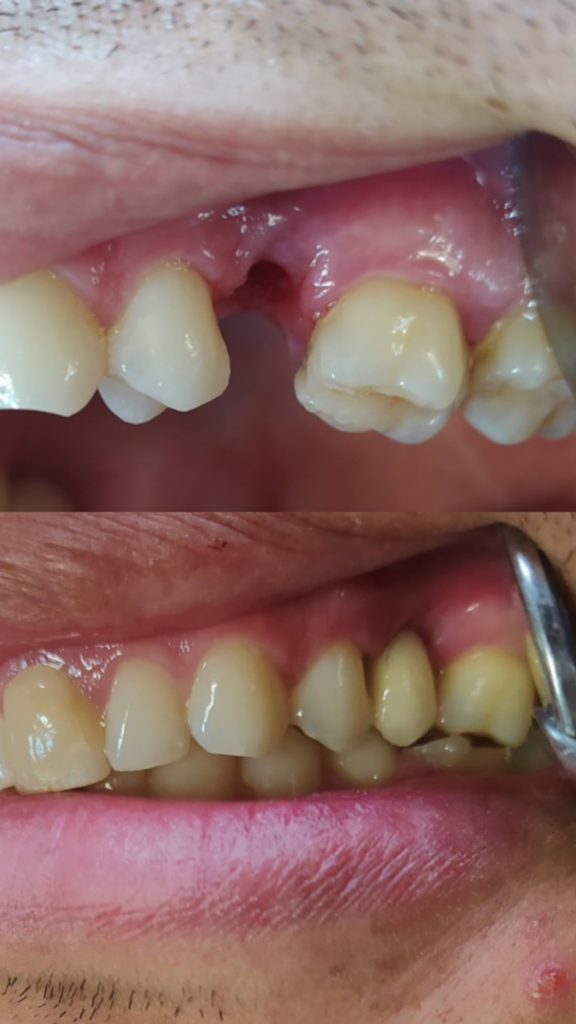 0FBFF473-D36D-4EEE-8A15-48765AA0D95D 1