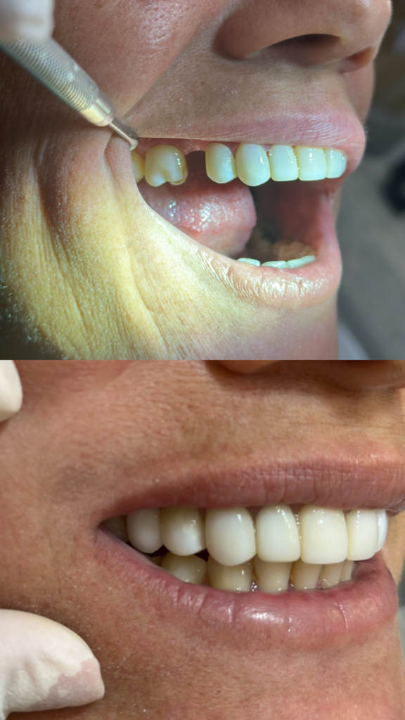 456CA6F1-2314-4F5D-B9BE-77955D5061A8 1