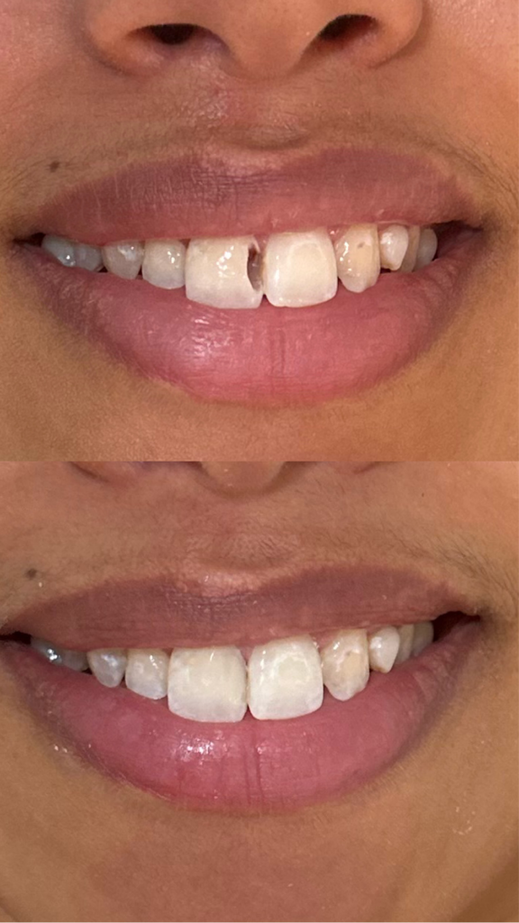 84F4CB1A-9B5A-4BFC-B583-9E2CDCFC3BFC 1