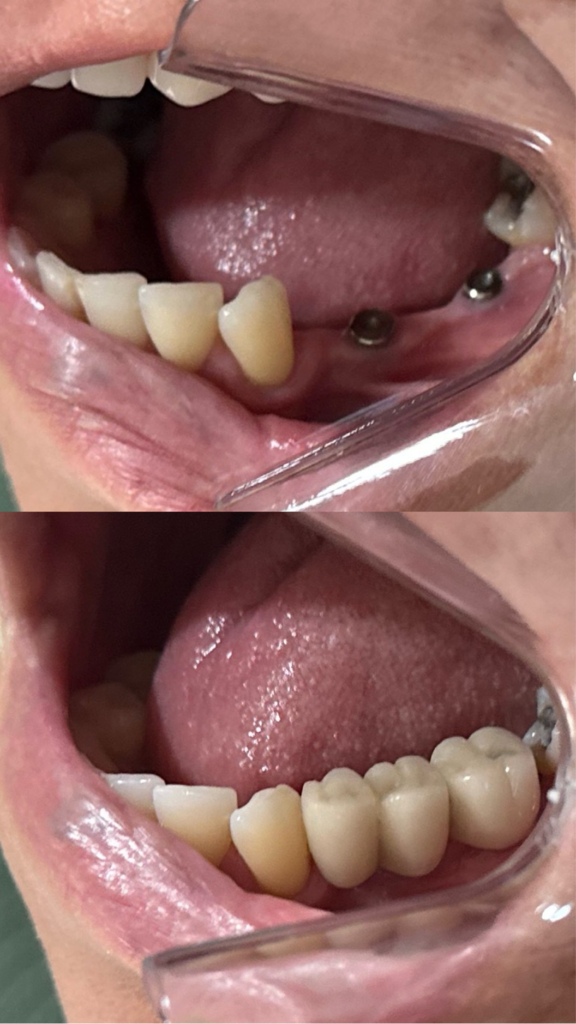 9B8D14A4-D671-4974-A940-9A3EDBA388E3 1