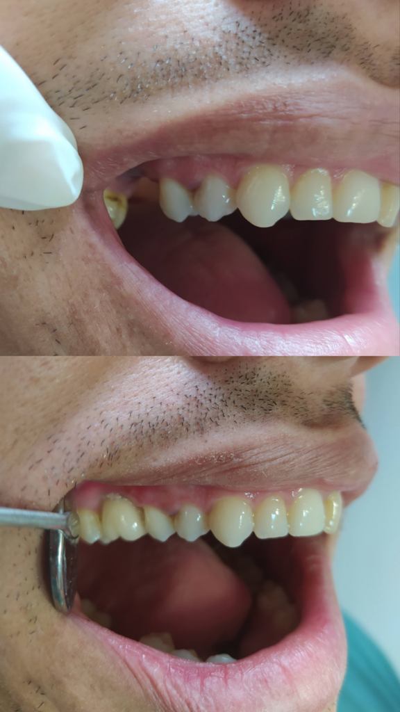 BC00CE3D-6669-4AA5-A3CF-1F131EFA2331 1